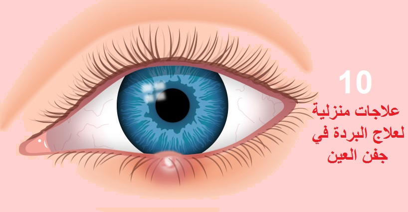 علاج البردة في العين - ليدي بيرد